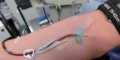 biomat plasma